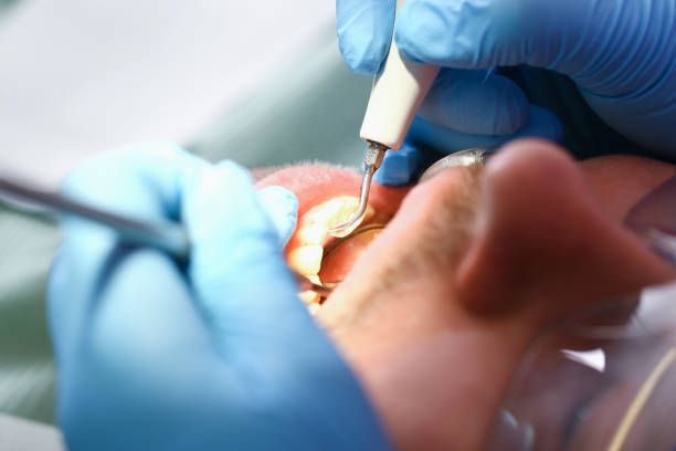 Trusted IN Emergency Dental Service Experts