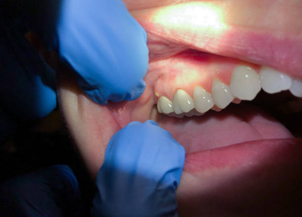 Best Walk-In Emergency Dental Services in North Vernon, IN